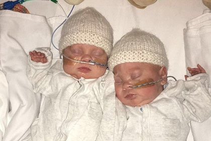 Twins who were born at the 24-week abortion limit defy the odds to become thriving toddlers