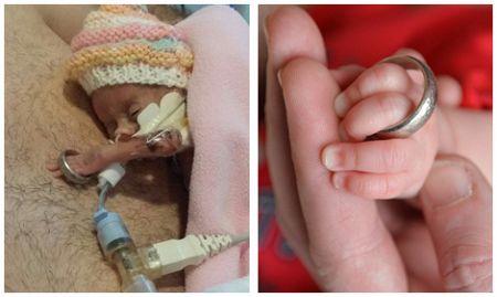 Home and thriving, the tiny 1lb baby girl whose arm slipped through her father's wedding ring when she was born.