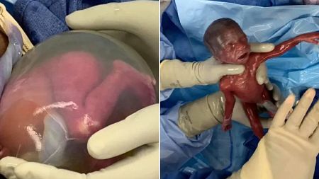 Mum shares amazing photos of premature twin girls who survived at 22 WEEKS