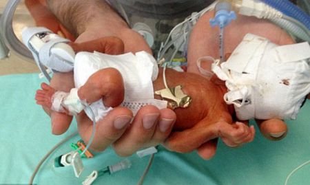 Hospitals Are Saving Babies Born at 22 Weeks Who Could be Killed in Abortions