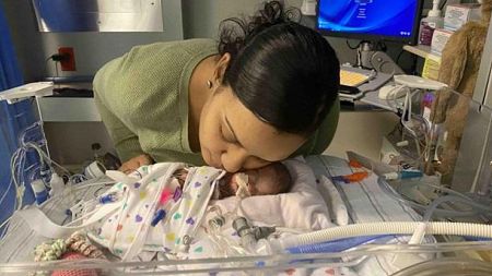 Mum shares amazing photos of premature twin girls who survived at 22 WEEKS