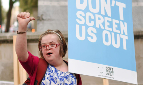 Woman with Down's syndrome calls for end to full term abortions for the condition