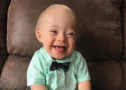 Meet Lucas, the first ever baby with Down's Syndrome to be Crowned the ...