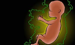 Hear the unborn speak - Daniel Holmes