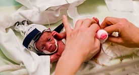 Baby born at 22 weeks survives against the odds