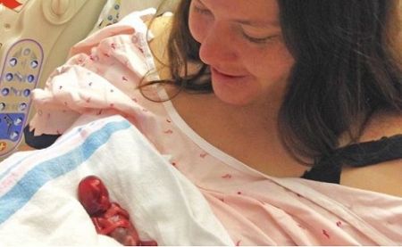 Pro-life mom who miscarried at 13 weeks stunned to see 'perfectly formed tiny baby'