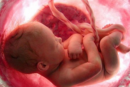 Worldwide abortion stats will strengthen Precious Life's resolve to protect unborn babies in Northern Ireland in 2022