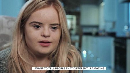 Teen model with Down's syndrome says ‘You can do anything’