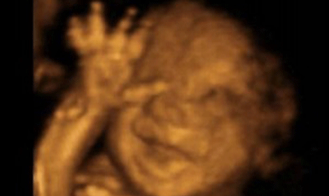 Warning over burning aborted foetuses