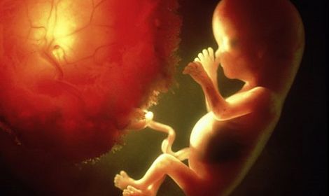 Precious Life responds to Irish Times article: