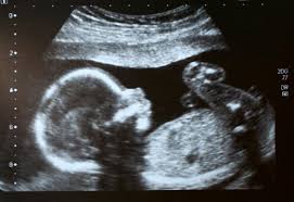 Alabama Man Sues Abortion Clinic on Behalf Of Unborn Child