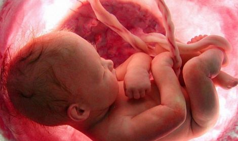 Worldwide abortion stats will strengthen Precious Life's resolve to protect unborn babies in Northern Ireland in 2022