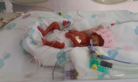 Miracle Belfast baby born 4 MONTHS early with less than 1% chance of survival still fighting for life
