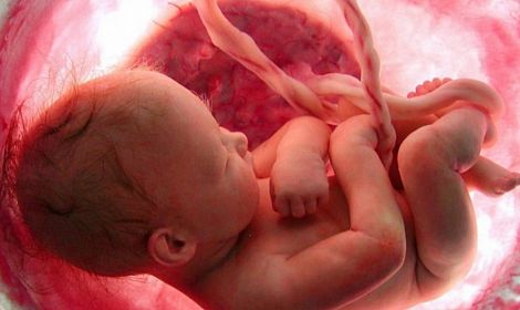 Abortion Was the Leading Cause of Death Worldwide in 2023