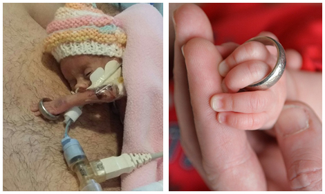 Home and thriving, the tiny 1lb baby girl whose arm slipped through her father's wedding ring when she was born.
