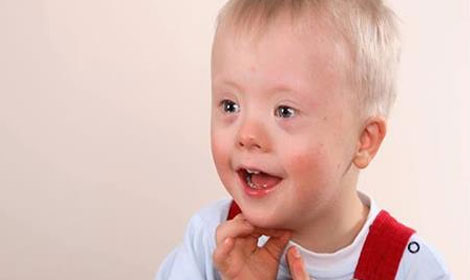 Half of all babies aborted because they have Down's syndrome are missing from official records due to poor administration in clinics