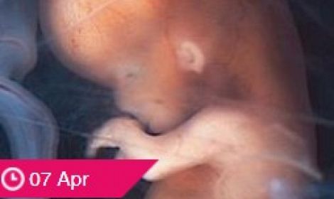 PRESS RELEASE: Precious Life slam Michelle O'Neill's 'outrageous' push for dangerous and deadly DIY home abortions in Northern Ireland