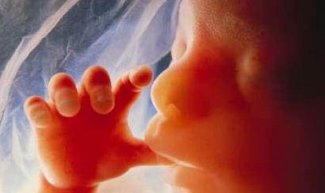 DISGRACEFUL: Irish Abortion Committee votes for abortion on demand up to 12 weeks